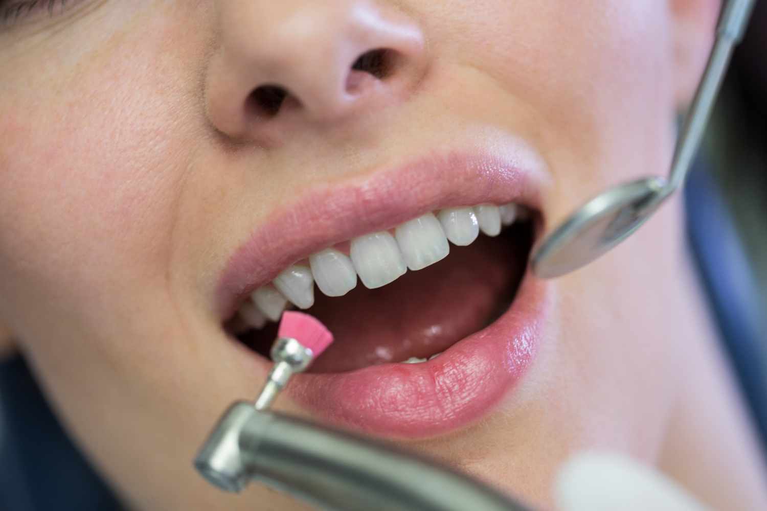How to Reinforce Tooth Enamel? - White Zone